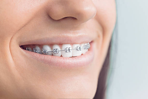 Why Choose Us for Your Dental Needs in New Orleans Station, LA